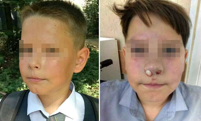 В Самаре избили школьника